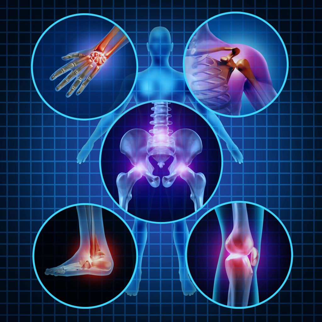infiltration prp arthrite